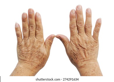 Old Female Hand Full Of Freckles                                