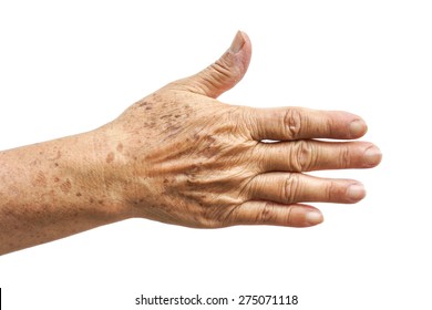 Old Female Hand Full Of Freckles                               