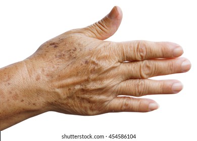 Old Female Hand Full Of Freckles                           