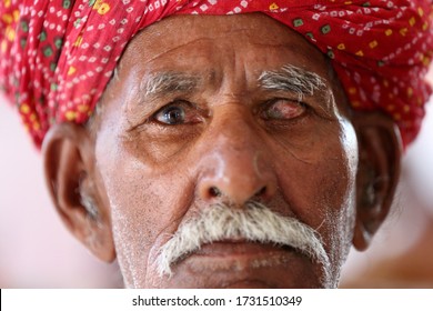 Old Indian Man In Long White Mustache And Wearing Red Turban Suffering From Eye Problem. Cataract In Eye. Loss Of Vision. Damaged One Eye. Eye Disease. 