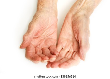 Old Lady's Hands Open - My Mother At 90 Years Old With Arthritic Hands