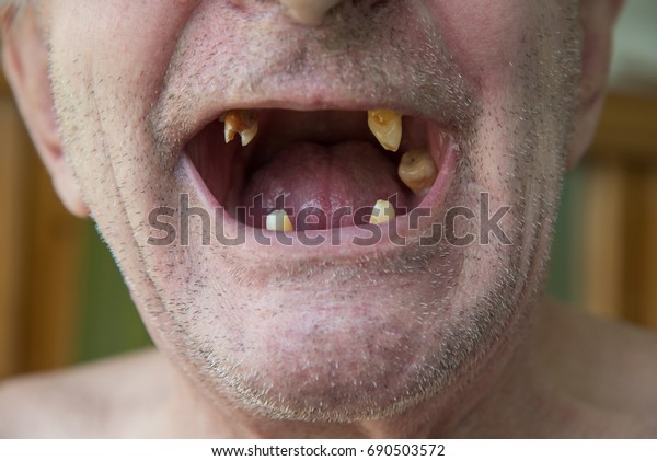 teeth bristles