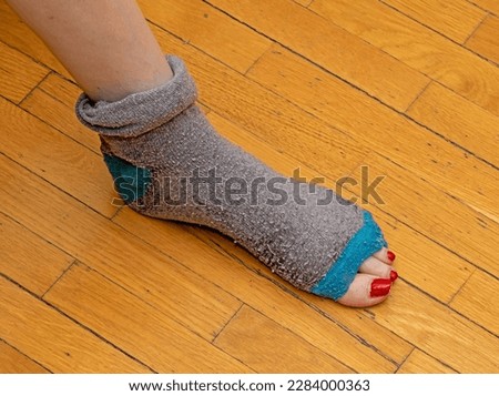 Old tacky sock completely torn apart with foot toes peeking out