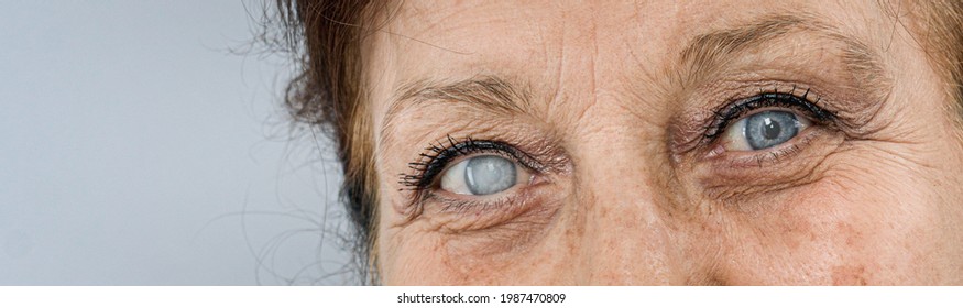 Old Woman  Sick Eye Detail Close-up