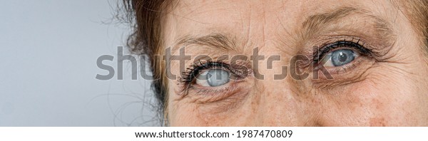 old woman  sick eye\
detail close-up