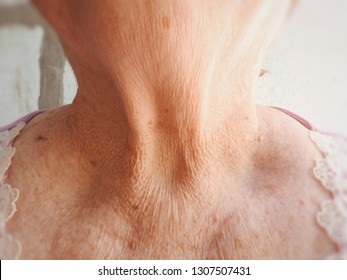 Old Woman's Neck