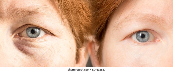 Old and young woman eye