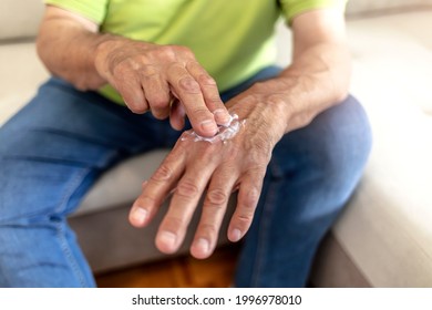 An Older Man Using Hand Cream Against Varicose Veins. Men's Hand Using Moisturizing Cream, Skin And Hand Care. Close Up View Of Mature Male Hands Moisturizing His Hands With Cream. Copy Space.