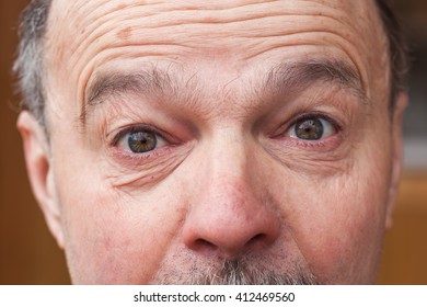 Older Man's Eyes Widened In Surprise And Shock