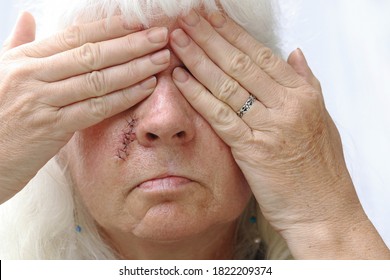 An Older Woman Has A Scar On Her Face And Is Ashamed Of It