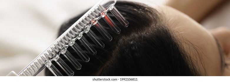 On Female Hair There Is Device For Restoration Of Hair Follicles