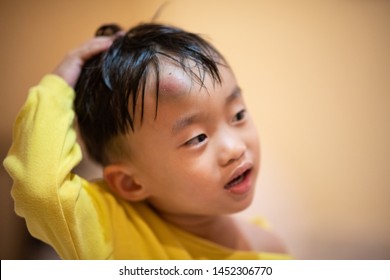 On Painful Swollen Forehead Of Boy Injured From Accidental Fall.