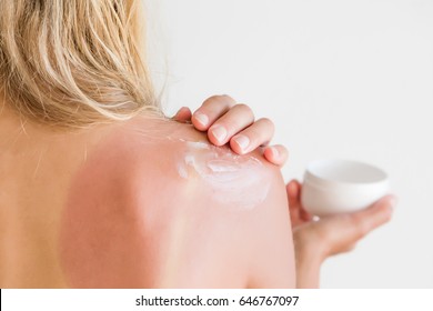 On Woman's Back Skin Smears Cream After Sun Burn.  