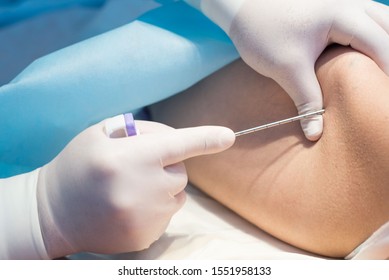 An Oncologist, Using A Long Needle, Pierces A Childs Ilium To Diagnose Bone Marrow For Leukemia, Ewings Sarcoma