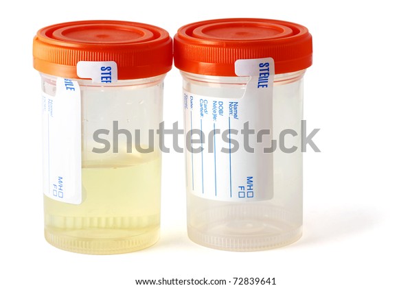 ready sterilised bottles