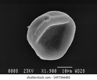 One Hornbeam Pollen Grain Scanning Electron Micrograph