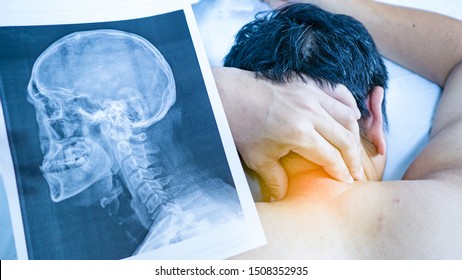 One Man Use His Hand To Hold The Neck. He Felt Pain From The Neck Bone  Herniated Disc And Have X-ray Film Sheet Placed Near. Concept  Neck Pain Or Cervical Spondylosis.