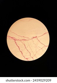 one of the microbial bacteria when observed in a microscope