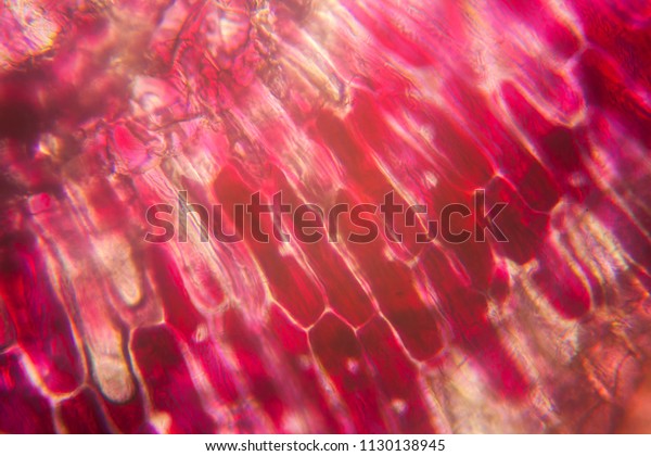 Onion cells at the microscope\
