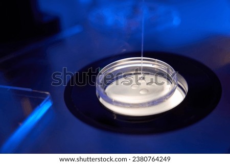 Oocyte sample collection process before vitrification procedure