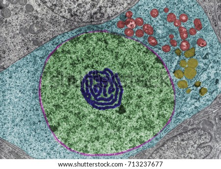 Oogonium. False colour TEM micrograph showing the nucleus (green), nuclear envelope (pink), an atypical nucleolus (dark blue). Mitochondria (red) and lipid droplets (yellow) in the cytoplasm (cian).