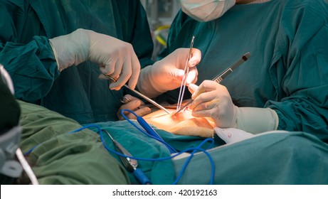 Open Heart Surgery For Coronary Surgery