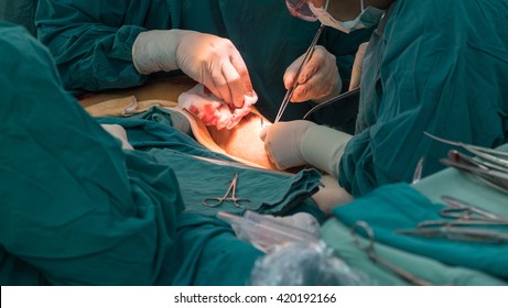 Open Heart Surgery For Coronary Surgery