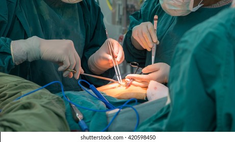 Open Heart Surgery For Coronary Surgery