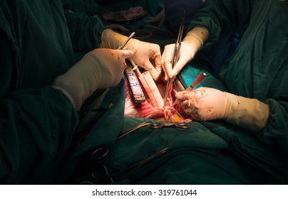 Open Heart Surgery Team