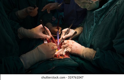 Open Heart Surgery Team