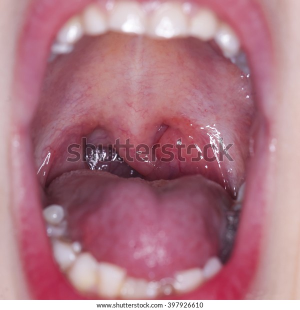 Open Throat Stock Photo (Edit Now) 397926610