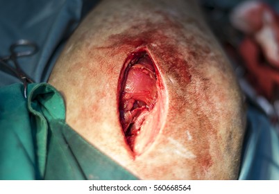 Open Wound For Treatment Canine Bone Fracture
