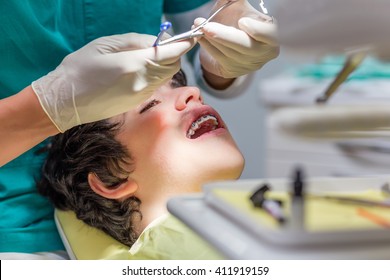 open-mouthed boy lying in the dental chair while the orthodontist is arranging the braces on teeth