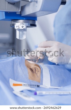 Operating microscope above a marked eyelid as a gloved surgeon prepares instruments for blepharoplasty in a modern clinic