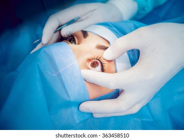 The Operation On The Eye. Cataract Surgery