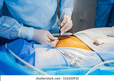 93 Peritoneum cavity Images, Stock Photos & Vectors | Shutterstock