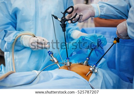 Operation using laparoscopic equipment