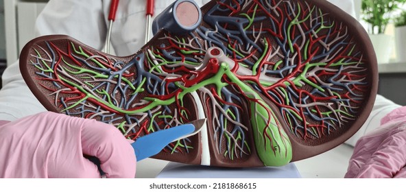 Operations on liver and gallbladder and hepatobiliary zone. Surgeon is holding scalpel and liver with gallbladder in simulating surgical operation - Shutterstock ID 2181868615