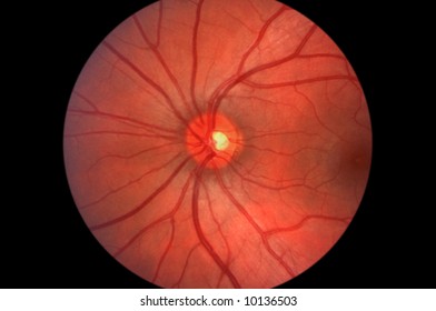 Ophthalmic image detailing the retina and optic nerve inside a healthy human eye