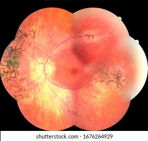 Ophthalmic image detailing the retina and optic nerve inside a healthy human eye. Health protection concept