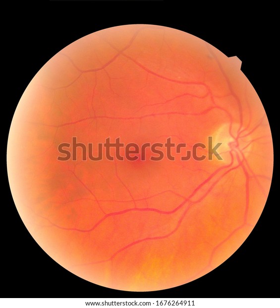 Ophthalmic image detailing\
the retina and optic nerve inside a healthy human eye. Health\
protection concept