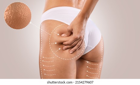 Orange Peel Effect Concept. Closeup cropped back rear view of young fit lady pinching buttocks and thigh skin with drawn arrows examining cellulite, wearing white panties isolated on studio background