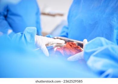 Organ transplant, hands and doctor surgery, medical support or teamwork on liver, healing accident injury or anatomy. Emergency, lung blood and closeup surgeon collaboration in ICU healthcare service