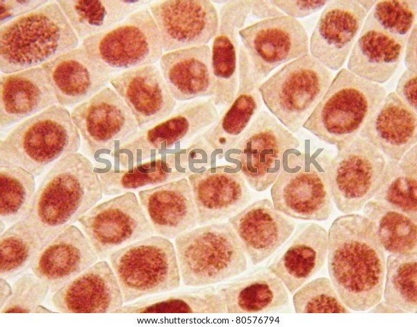 Original microphoto of mutant cell (cells
with small red microniclei precursor cancer) and you can see light
nucleoli on the nucleus of interphase cell. Mutations caused by
silver nanoparticles