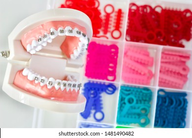 rings for braces