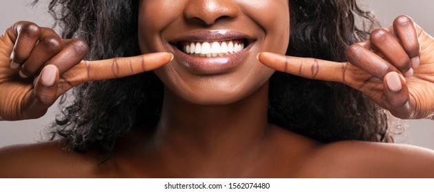 Orthodontic concept. Unrecognizable african american girl pointing at her healthy white teeth and widely smiling, panorama - Shutterstock ID 1562074480