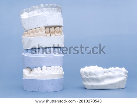 Orthodontic concept: vertical stack of dental gypsum molds with invisible braces next to a separate plaster jaw model.