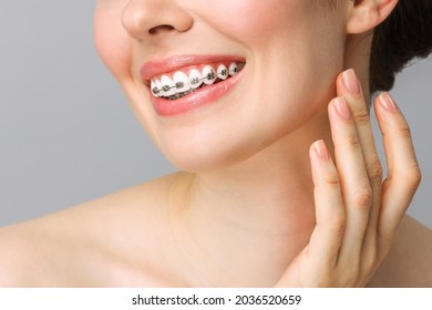 Orthodontic Dental Care Concept. Woman Healthy Smile Close Up. Closeup Ceramic And Metal Brackets On Teeth. Beautiful Female Smile With Braces.