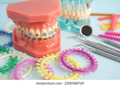 Orthodontic ligatures rings and ties, elastic rubber bands on orthodontic braces, model for dentist studying about dentistry.