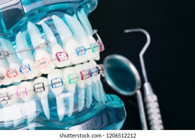 orthodontic model and dentist tool - demonstration teeth model of varities of orthodontic bracket or brace - Shutterstock ID 1206512212